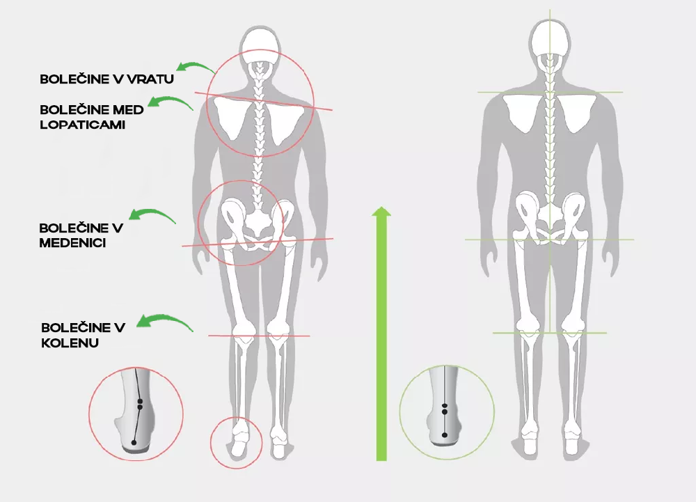 JALAS zaščitna obutev in vložki